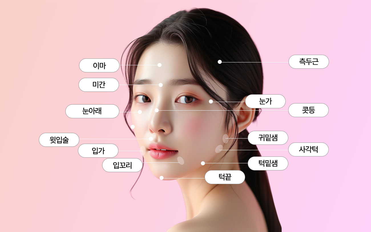 얼굴 보톡스 시술부위