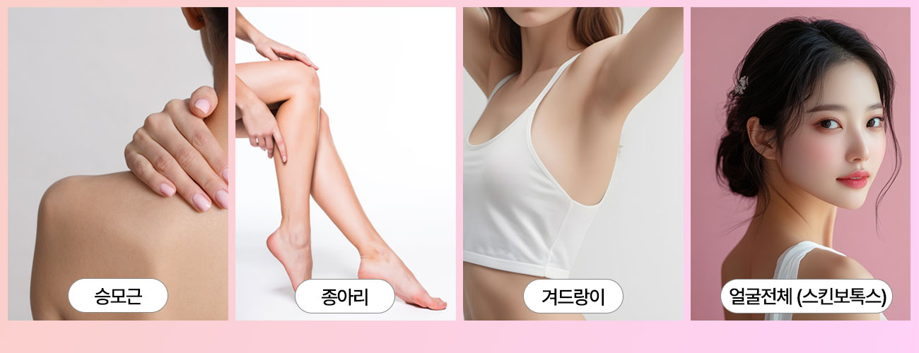 바디 보톡스 시술부위