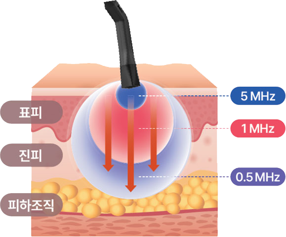 다중 주파 순차 조사 기술