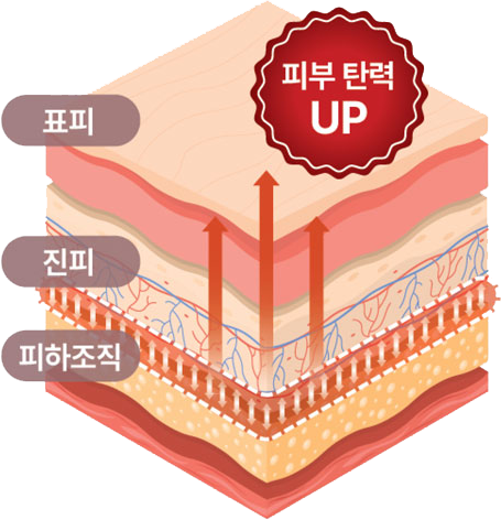 큐브리프팅 피부 탄력 원리