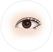 매몰식쌍꺼풀 수술후