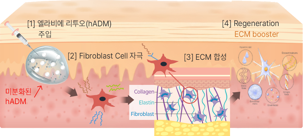 리투오 ECM 재생 과정