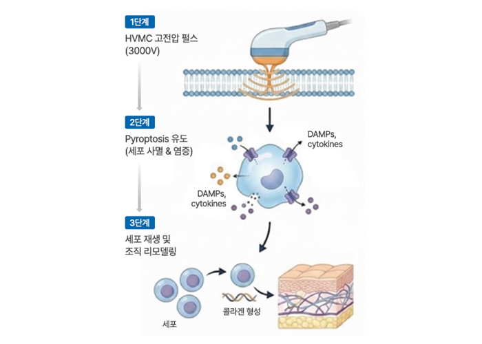 HVMC와 Pyroptosis 설명 이미지